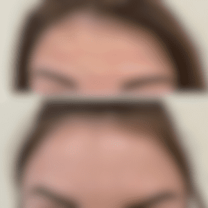 INSTAGRAM Haber Sablon 15 - Mega TV